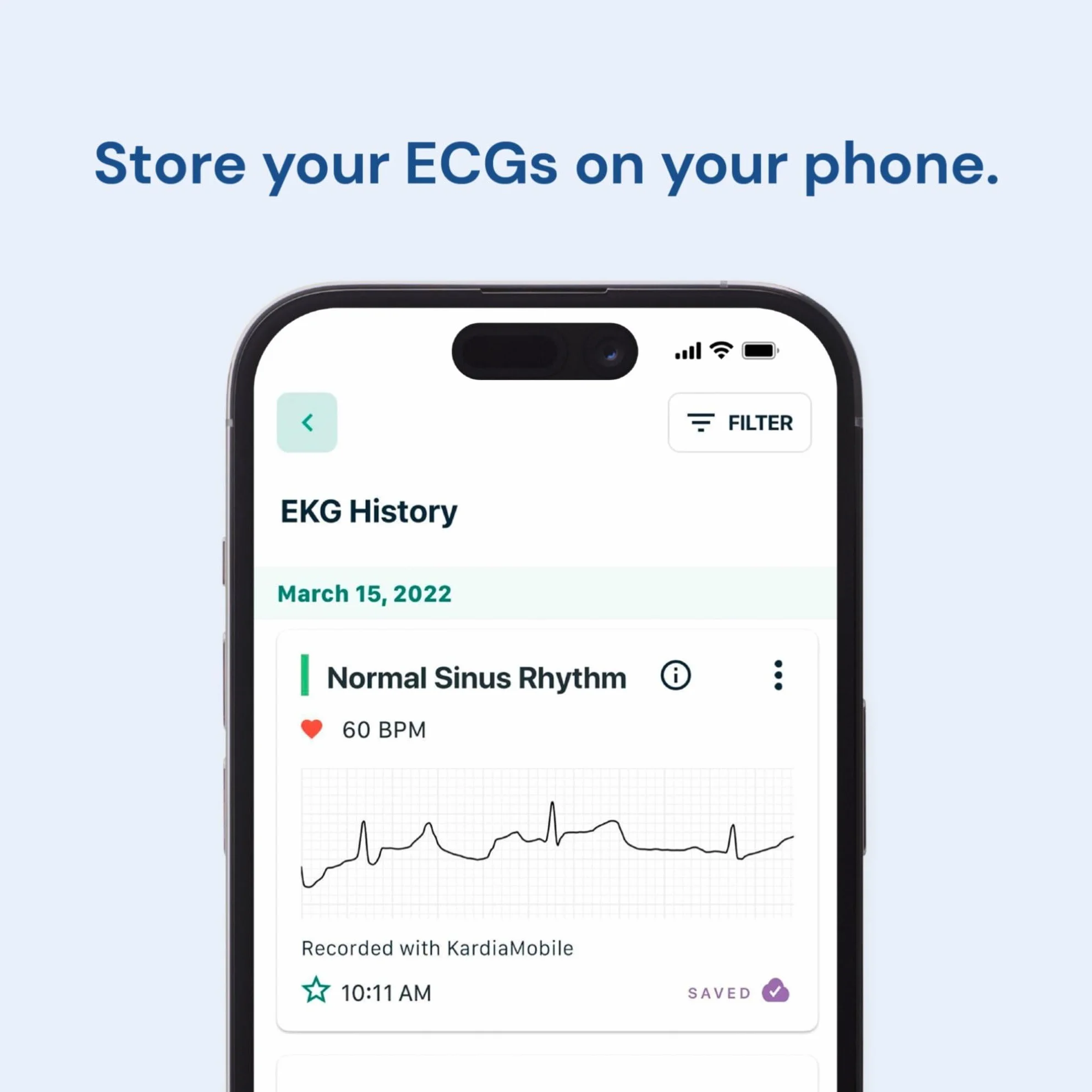 KardiaMobile 1-kanałowy czujnik tętna EKG + 1 miesiąc Kardiacare – zapis EKG w domu – wykrywa migotanie przedsionków – natychmiastowe rezultaty w 30 sekund – działa z większością smartfonów