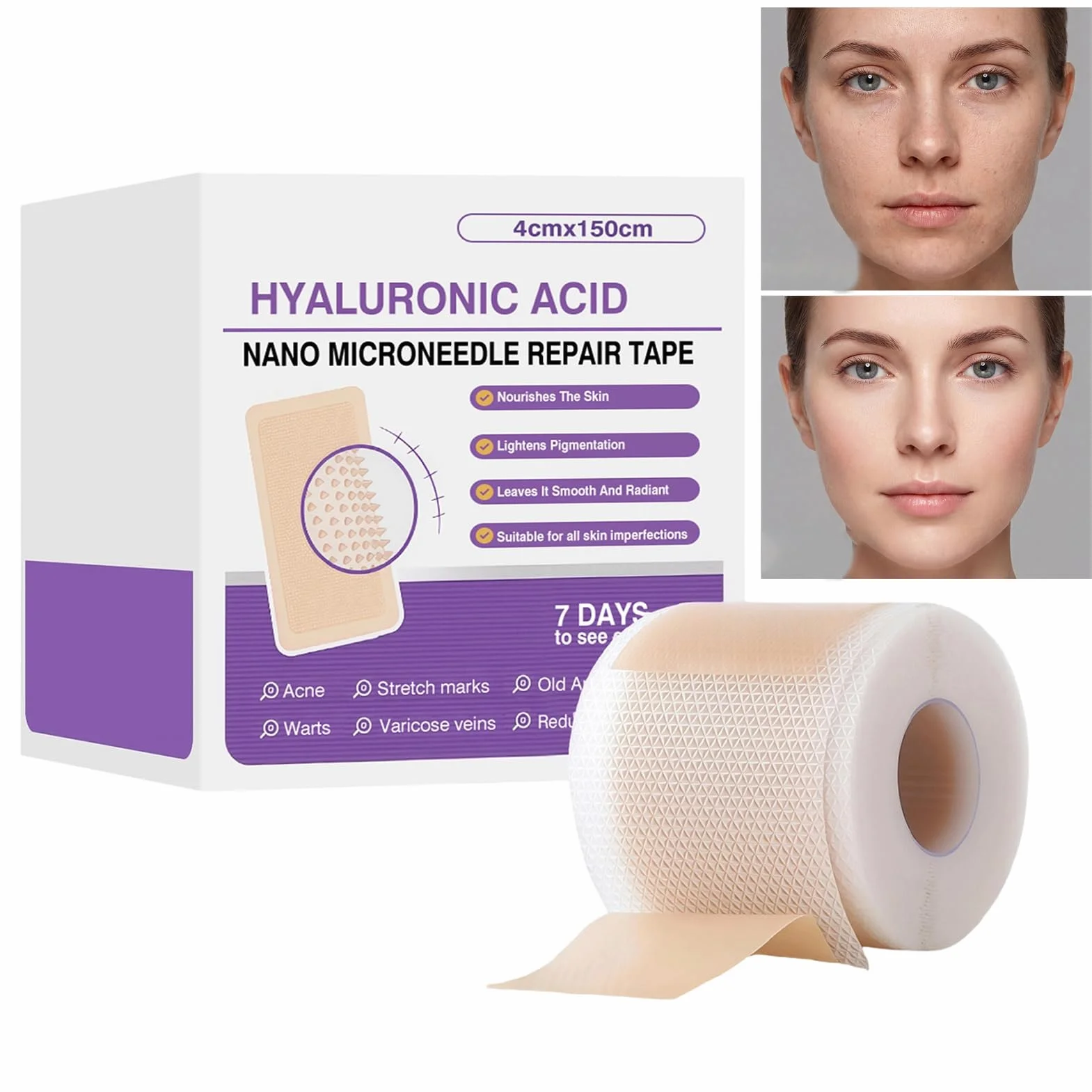Silicone Scar Tape 4x150cm Reusable Elastic Skin Patch for Face Body Stretch Marks Burn Care