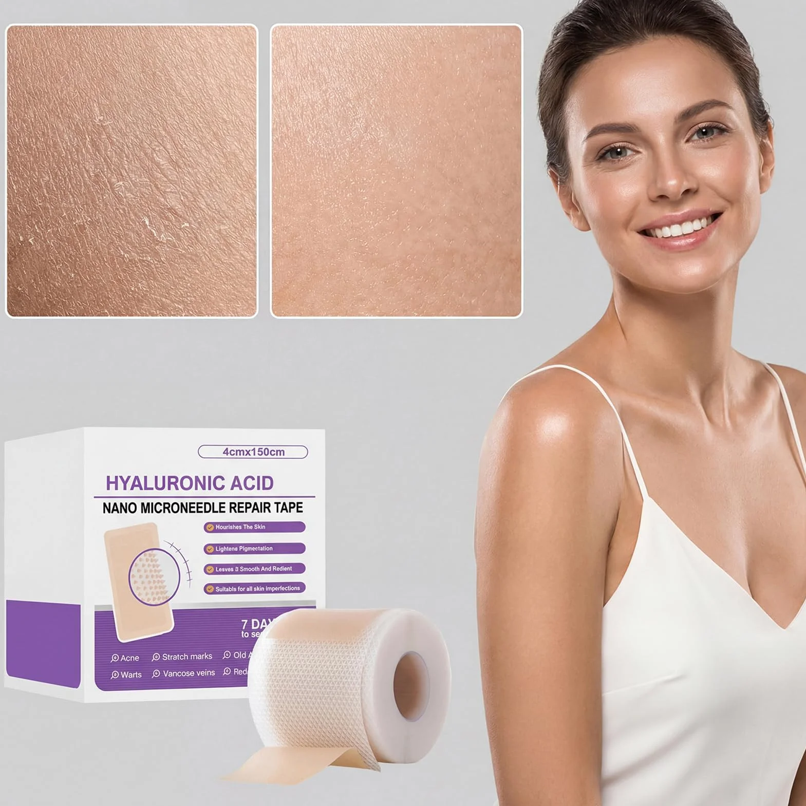 Silicone Scar Tape 4x150cm Reusable Elastic Skin Patch for Face Body Stretch Marks Burn Care
